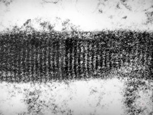 clotted blood - fibrin